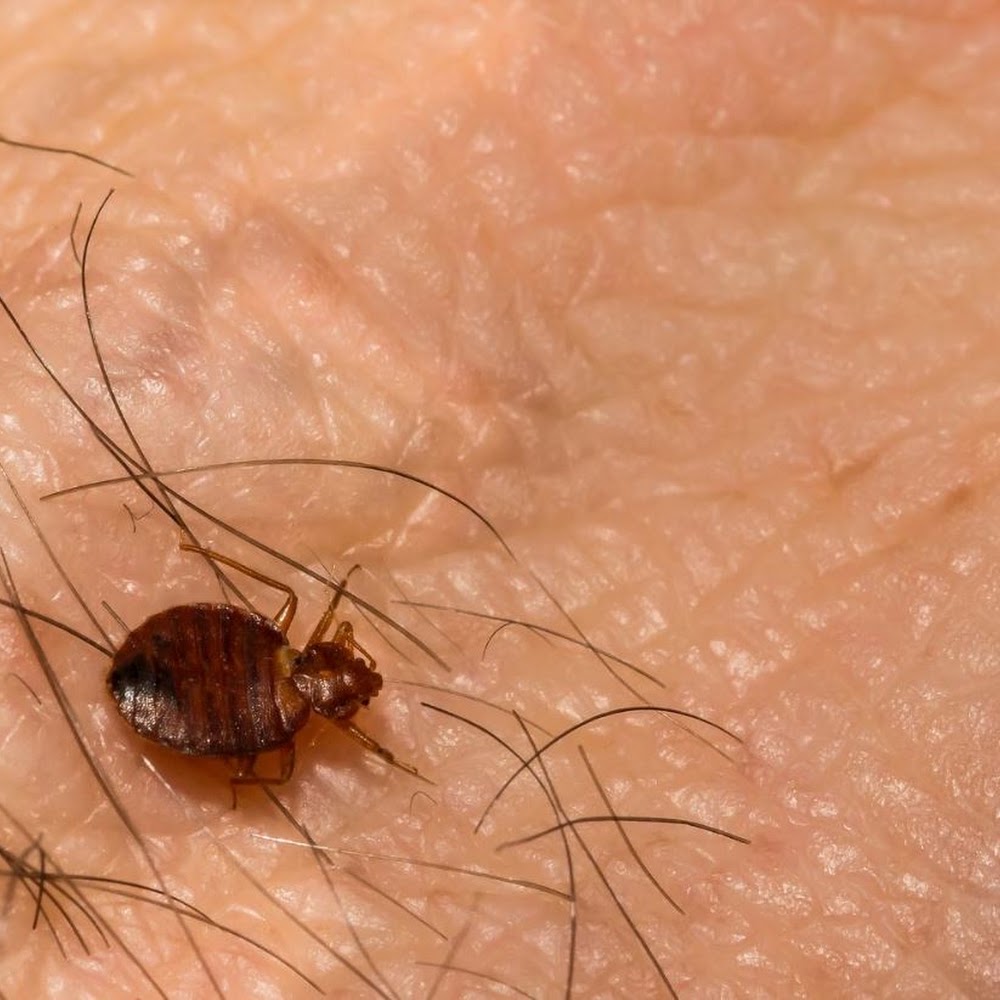 Pests R Us Ltd Pest Control - Central London